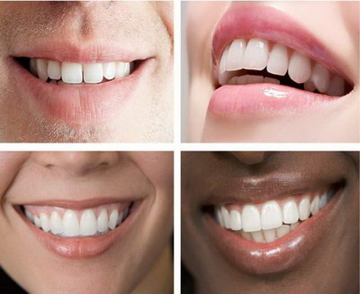 光固化补牙后一般能维持几年