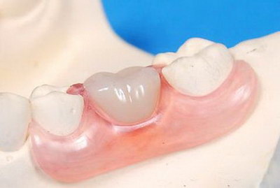 乳牙做根管治疗疼吗(乳牙根管治疗的意义)