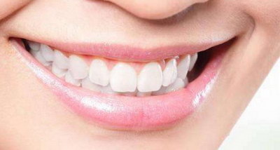 完美牙齿x光图片_网上买的美牙仪有效果吗
