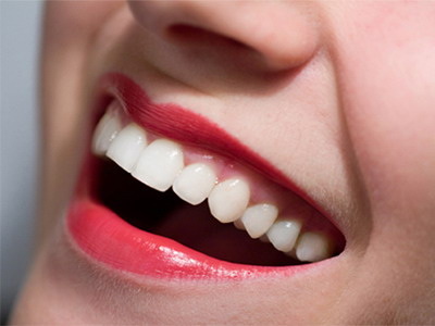 如何治疗牙菌斑牙龈出血