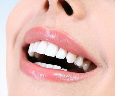 牙结石对牙齿的危害如何去除