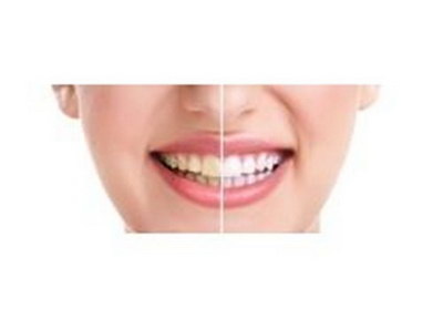 牙龈萎缩手术怎么治疗