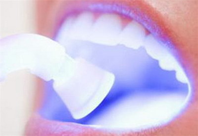 牙齿矫正手术后多久可以长好_牙齿矫正手术后多久有效果