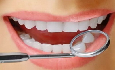 牙黄怎么治疗方法