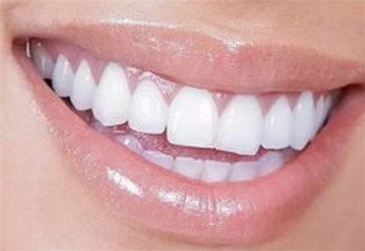 牙齿不整齐原因有哪些_牙齿表面有裂痕怎么办