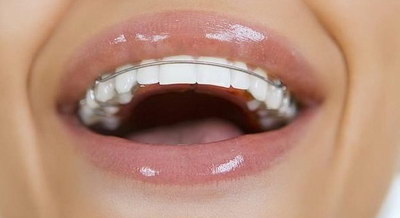 拔牙来月经有什么影响_拔牙后需要注意些什么