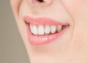 地包天牙齿矫正可以改变脸型吗