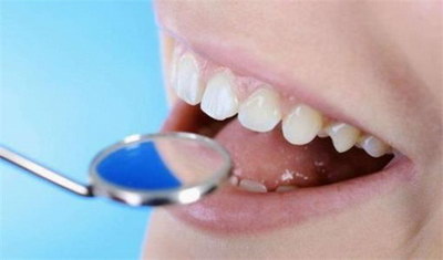 牙齿外凸导致的嘴突箍牙要多久