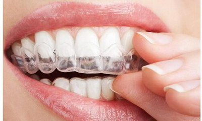 怎样才能使牙齿很白_牙齿矫正保持器什么样子
