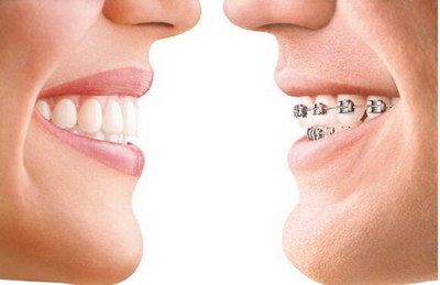 牙龈反复起脓包怎么解决_龈下刮治多久牙龈恢复