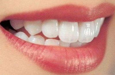 牙齿容易蛀牙是什么原因