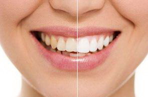 牙齿保髓治疗_牙齿开始出现缝隙什么原因