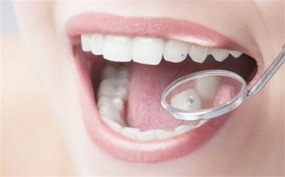 牙髓炎的牙齿能拔掉吗