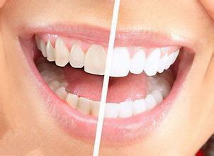 牙齿植骨粉_换牙期如何预防牙齿排列不齐
