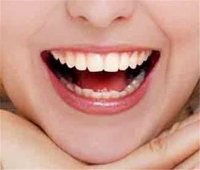 拔智齿医保报销比例是多少_拔智齿后副作用