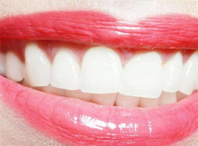 牙龈上有白色的点点(牙龈上白色的小点点)