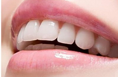 四环素牙齿美白多少钱_四环素牙齿美白最好的方法