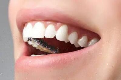 牙龈切除术的收费标准