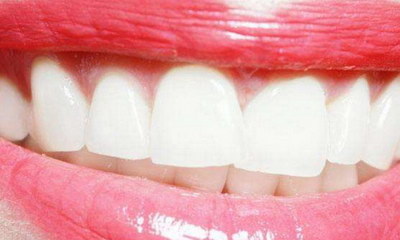 无痛洗牙和普通洗牙有什么分别(无痛洗牙跟普通洗牙的区别)
