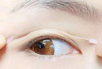 割双眼皮后十年后的后果是什么_北京割双眼皮最好的医生是哪位