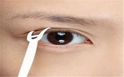 双眼皮拆线热敷降肿：介绍一种安全有效的整形美容方式