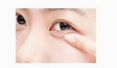 外眼角长斑：最常见的原因及其相应治疗方法