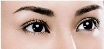 韩式双眼皮的优势：让你更有魅力！