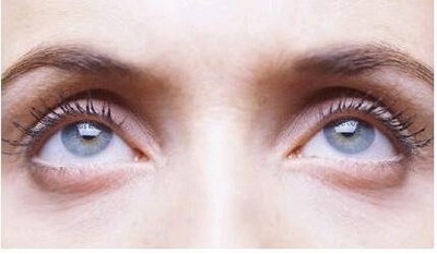 割双眼皮埋线怎么康复得快_割双眼皮埋线：一种新的改变眼睛外观的美容方案