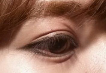 一只眼眼袋为什么突然肿了_祛眼袋手术和填充哪个好