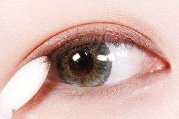 眼睛做埋线注意事项_做埋线双眼皮半个月了一个眼恢复了一个眼还肿正常么