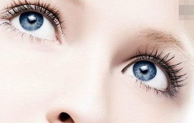 欧式双眼皮手术恢复过程
