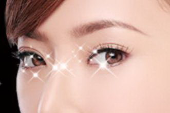 埋线法双眼皮手术方法