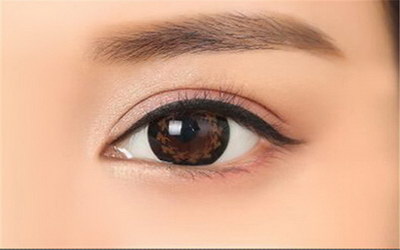 韩式双眼皮恢复两只眼睛不一样