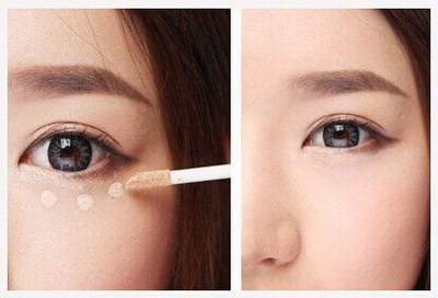 开眼角割双眼皮多久可以正常护肤(割双眼皮开眼角多久可以涂眼霜)