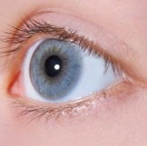 双眼皮术后充血严重怎么快速消除(双眼皮术后充血严重发红发紫)