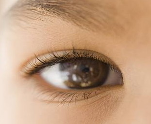 做双眼皮埋线能改善大小眼吗(埋线双眼皮可以改善大小眼吗)