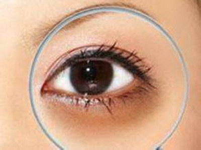 双眼皮术后眼角淤血：预防与应对