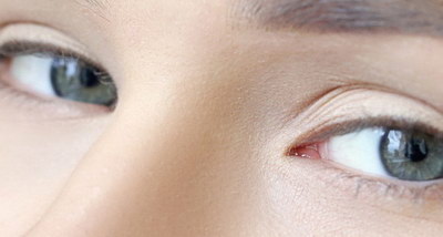微创双眼皮术常见的几种方法