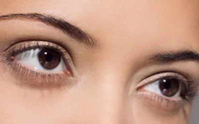 韩式双眼皮能保持多久？