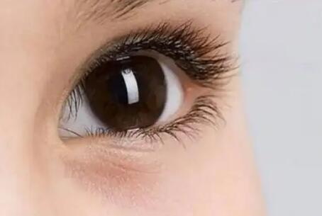 外眼角更加美观魅力_外眼角白色分泌物诊断与治疗