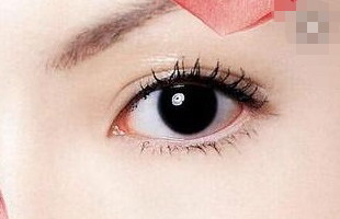 最好的韩式双眼皮专家_韩式双眼皮有哪些品种