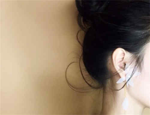 成都市锦江区耳垂损伤矫正前三-前五实力医生是你没看过的版本
