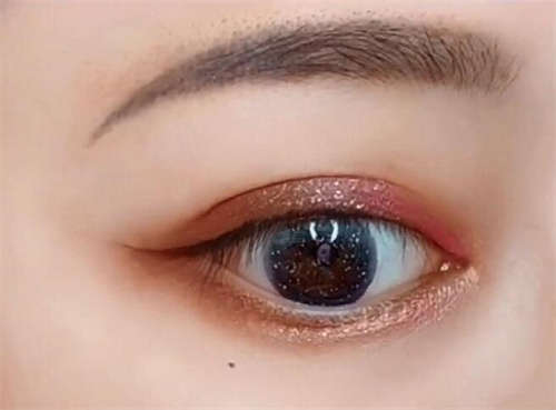 2023年运城市万荣县五点定位双眼皮手术权威整形医生排名榜